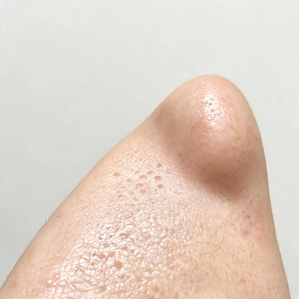 Cheek and side of the nose only, cropped below the eye line, showing oily shiny skin with enlarged pores, no eyes in frame.